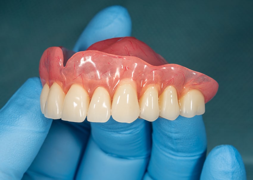 zubna proteza