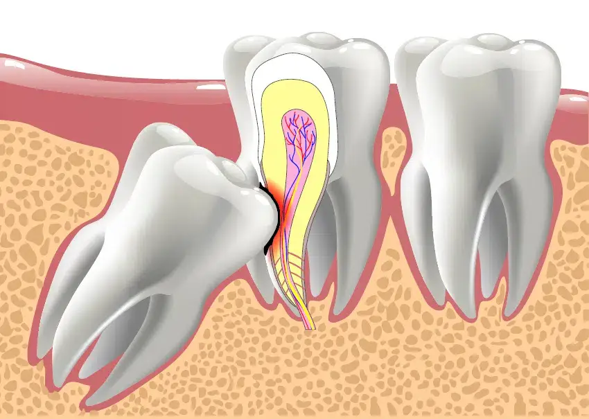 smartdental